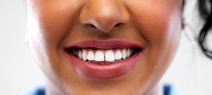 A woman with a small gap between her two front teeth before cosmetic dental bonding