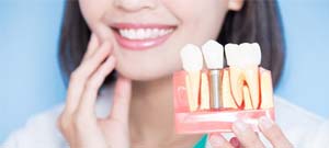 dentist holding a model of a dental implant in the jaw 