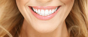 Woman sharing gorgeous smile after cosmetic dentistry