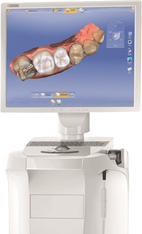 CEREC 3 D images