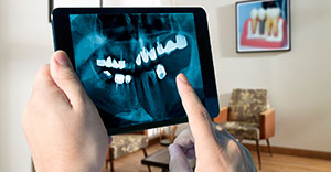 Dentist looking at panoramic dental x-rays