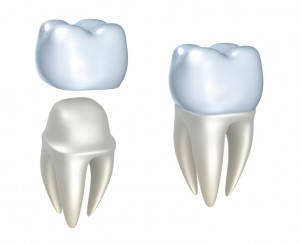 Your dentist for same day crowns in New York.