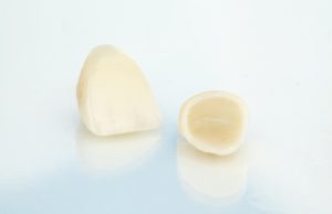 two dental crowns