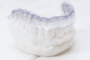 Invisalign aligners