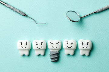 Dental implant illustration